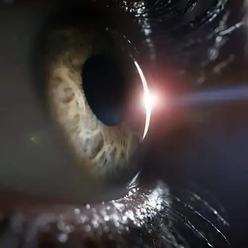 Cirugia Ocular Lasik